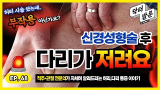 【허리】 신경성형술 시술까지 했는데, 다리가 저리다고요? 내가 알려줄게! 구독자Q\u0026Aㅣ닥발TV