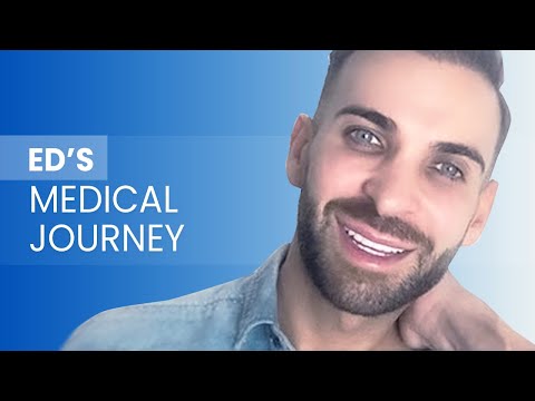 Dental Veneers in Turkey I Ed's Medical Journey I MrThirtySoing I Clinic Center Turkey