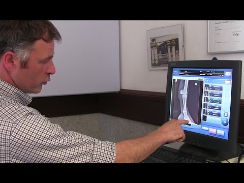 Herniation der Bandscheibe 5. April Er schlug seinen Kopf wunden Hals von hinten zu tun