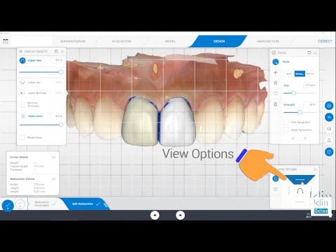 Major Tool Asset Missing in Current CEREC Software!