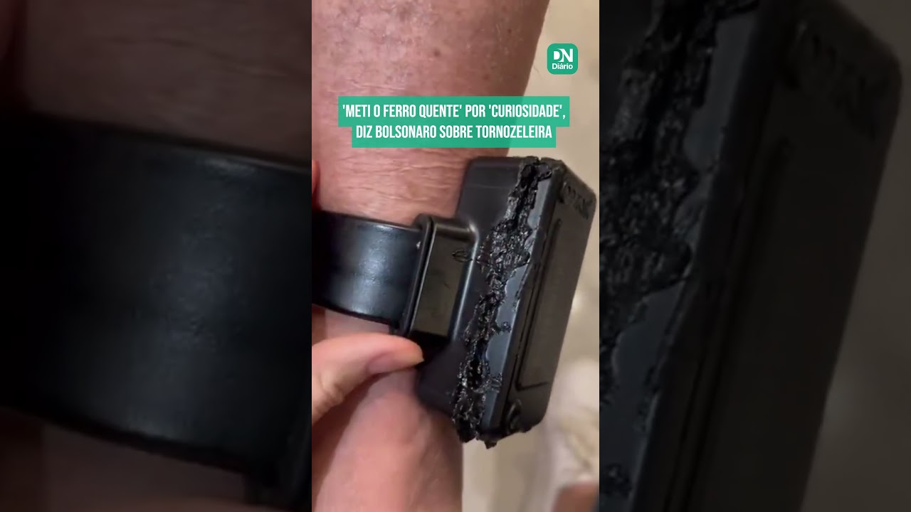 Imagem da notícia Bolsonaro admite danificar tornozeleira: 'Meti ferro quente'