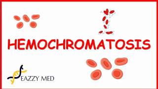 Hemochromatosis: causes,pathophysiology,signs and symptoms,diagnosis and treatment