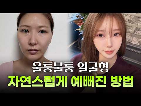 볼 처짐 완벽 방어하는 안면윤곽 3종과 미니거상 6개월 차! 리얼 환골탈태 풀페이스 성형후기 브이로그ㅣ디에이성형외과ㅣ콤플렉스극복