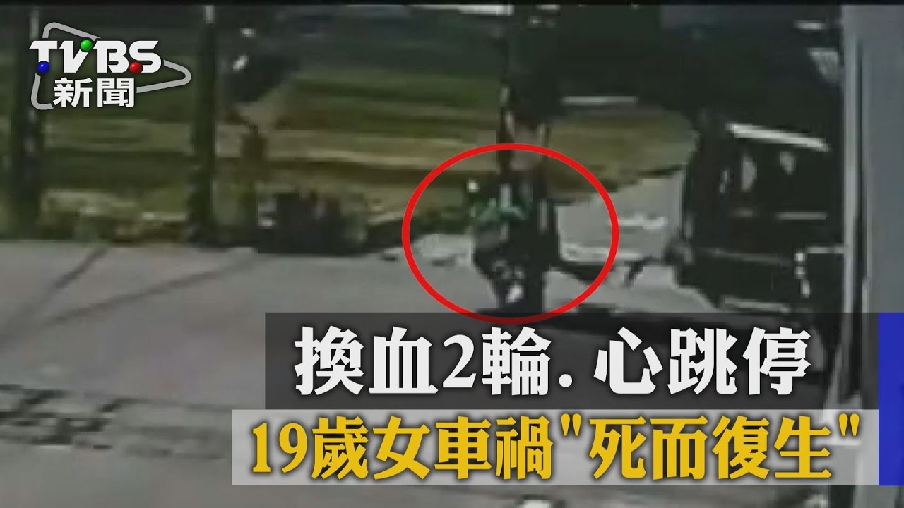 換血2輪、心跳停　19歲女車禍死而復生