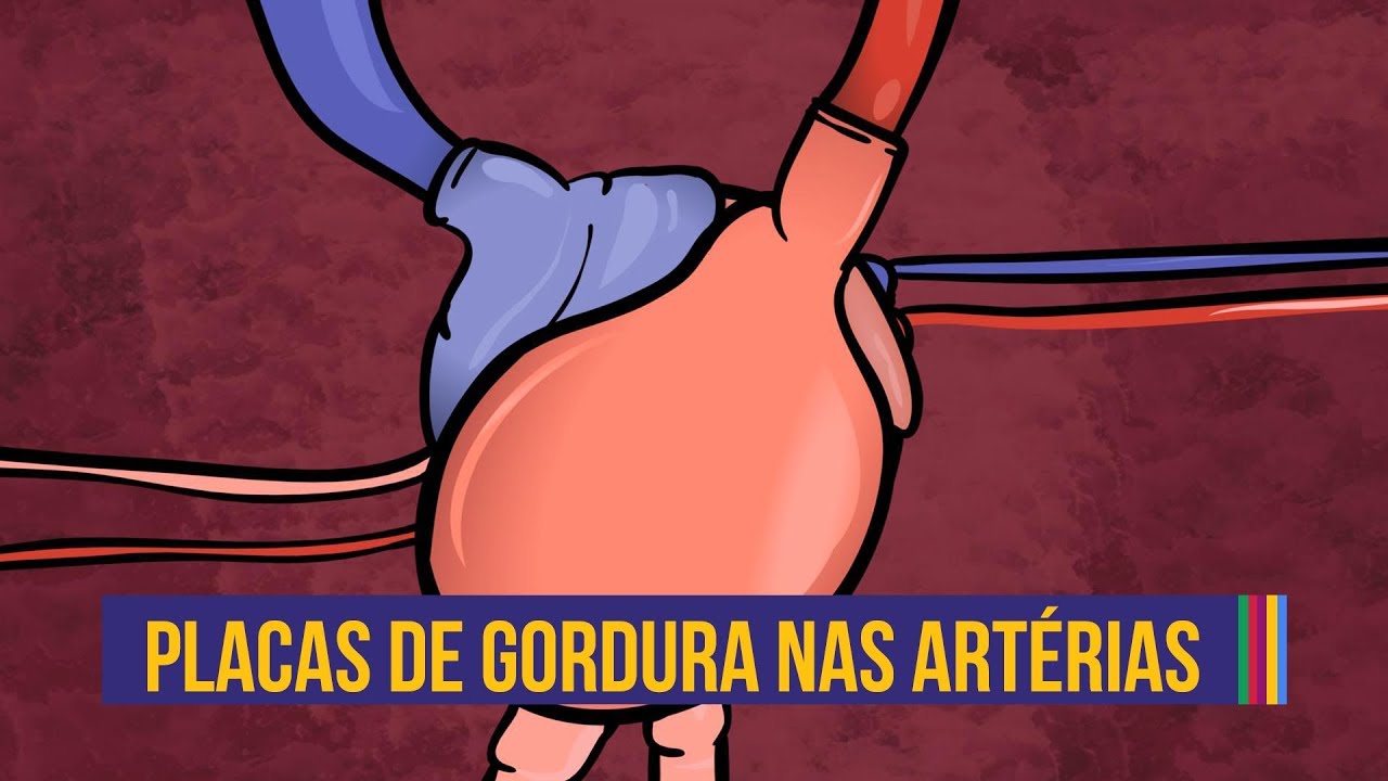 Como se formam as placas de gordura | Animação #08
