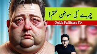Dr. Zee:Easiest Way to Fix the Swollen Face (Facial Puffiness) and Puffy Eyes  | डॉक्टर ज़ी