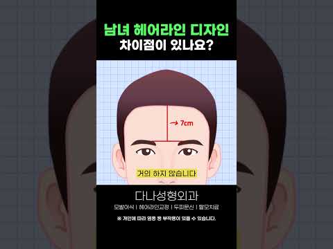 Q.남녀 헤어라인 디자인 차이점|모발이식|헤어라인교정|두피문신|탈모치료|다나성형외과|DANA #shorts