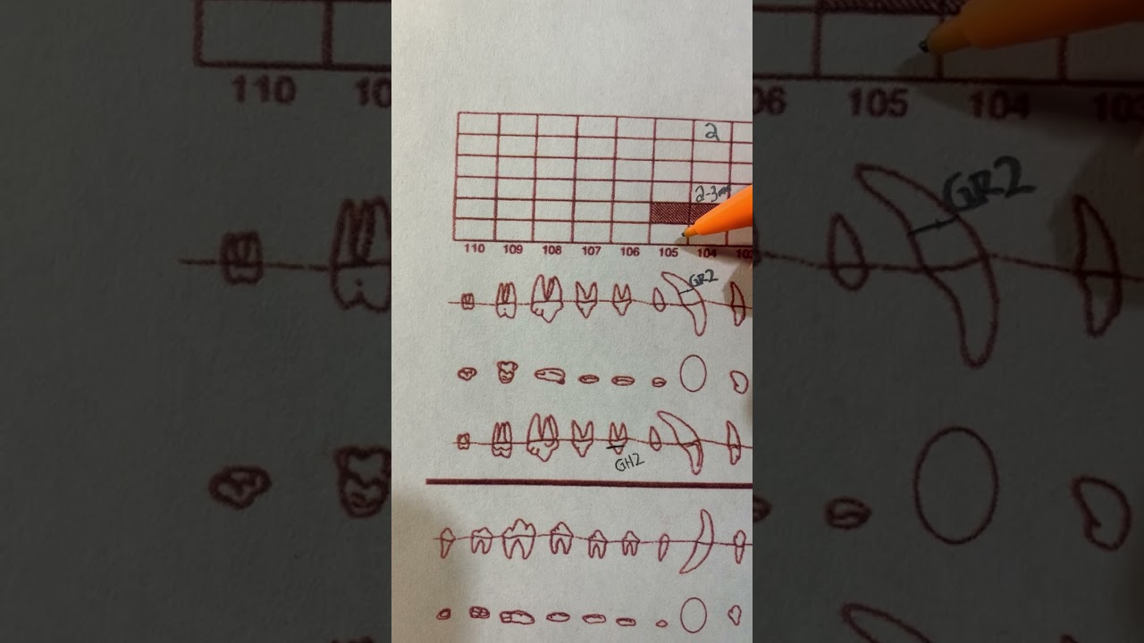 Dental charting - the basics