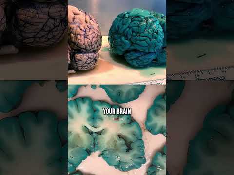 Methylene Blue Turns Your Brain BLUE?!