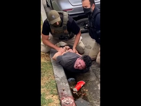 California man injured in violent ICE arrest