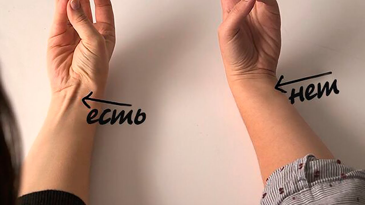 ВИДИТЕ СУХОЖИЛИЕ НА ЗАПЯСТЬЕ ВОТ ЧТО ЭТО ЗНАЧИТ...