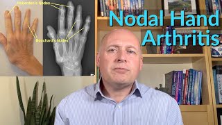 Hand & Finger Arthritis - The Very Best Self-Help Ideas