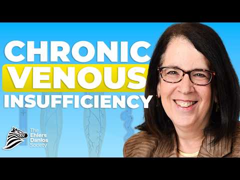 Venous Insufficiency in EDS and HSD
