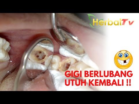 download video viral Cara Membuat Email Gigi, download Cara Membuat Email Gigi gratis, unduh video Cara Membuat Email Gigi