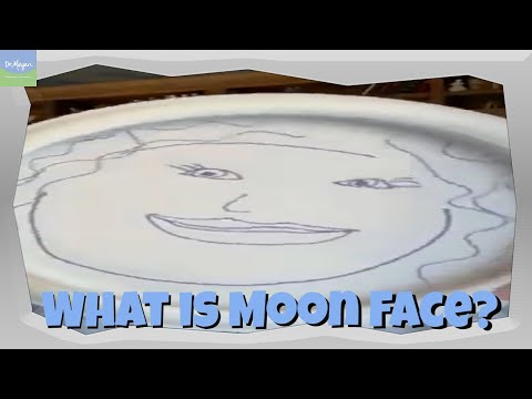 What is 🌚 Moon Face? (Prednisone Side Effect)