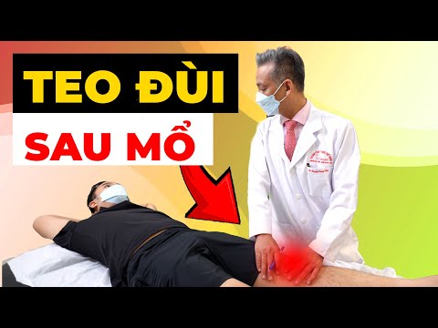 Teo Đùi Sau Mổ ACL: Nỗi Ám Ảnh Khiến Bạn Mất Tự Tin Và Cách Phục Hồi