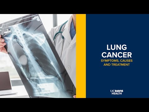 Lung Cancer - Symptoms, Causes and Treatment Options | UC Davis Health