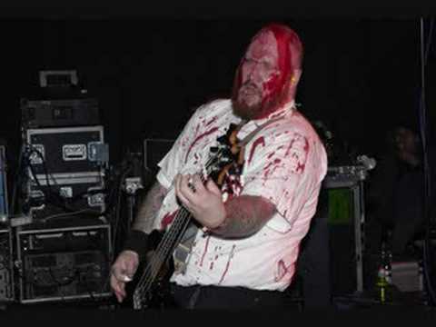 General Surgery - Fulguration online metal music video by GENERAL SURGERY