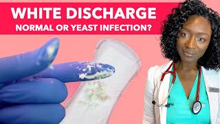 How To Stop Vaginal Yeast Infection & Itching | Vaginal Thrush Treatment | Is White Discharge Normal