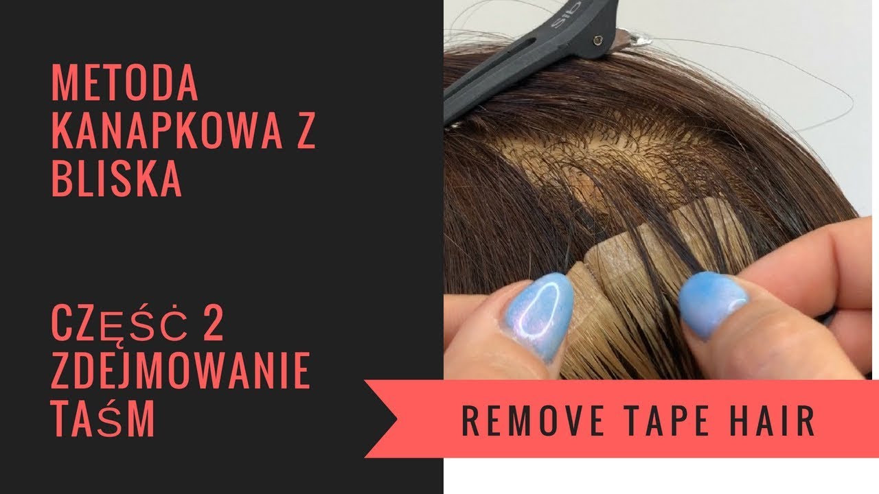 Metoda kanapowa TAPE ON zdejmowanie taśm z użyciem removera