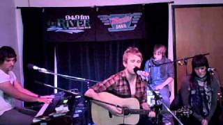 Scars on 45-Beauty&#39;s Running Wild (acoustic)