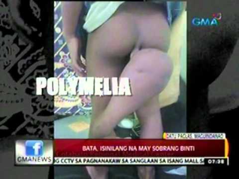 Ointments para sa dermatitis at kuko halamang-singaw Ointment pits BC mula sa kuko halamang-singaw review