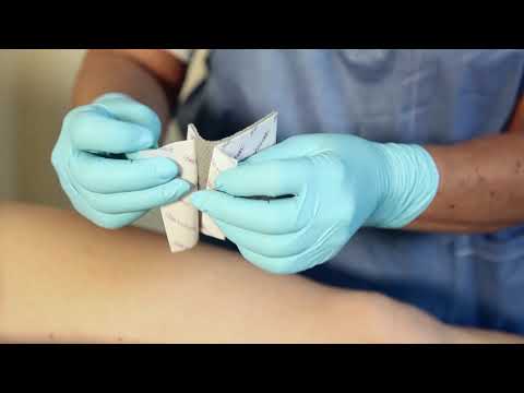 Mepilex® Transfer Ag - Anwendungsvideo - Mölnlycke Health Care