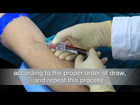 VACUETTE® QUICKSHIELD Complete PLUS - English Version