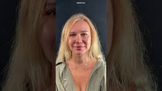 Подтяжка лица 83
