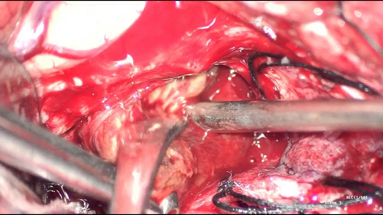 Jose Vicente Vasconez Fabre-33