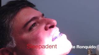 ¿Cómo funcionan los Dispositivos de Avance Mandibular Antironquido