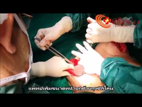 ชุดว่ายน้ำสำหรับความคิดเห็นหน้าอกเล็ก ครีม evinal การแสดงความคิดเห็นขยายเต้านม