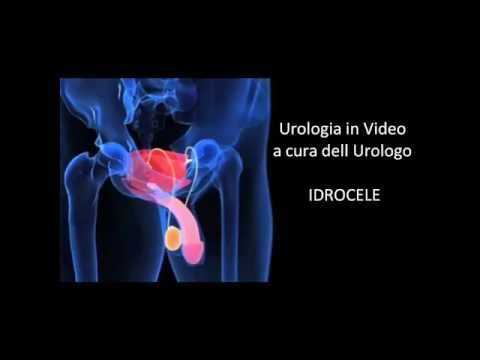 Prostamol suo analogo prezzo PSA per il cancro della prostata 14
