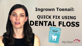 Ingrown Toenail: A Quick Fix With Dental Floss
