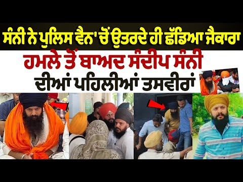 First pictures of Sandeep Sunny after the Patiala Jail attack, police reached hospital For Medical