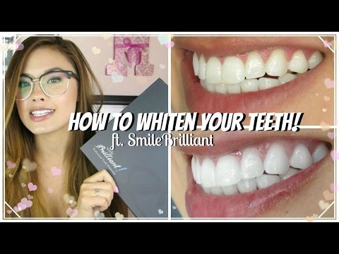 At Home Teeth Whitening! ft. Smile Brilliant