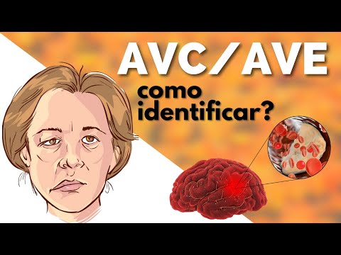 Acidente Vascular Encefálico  - AVC / AVE - O que é o AVE ? Como identificar AVE ? O que fazer AVE ?
