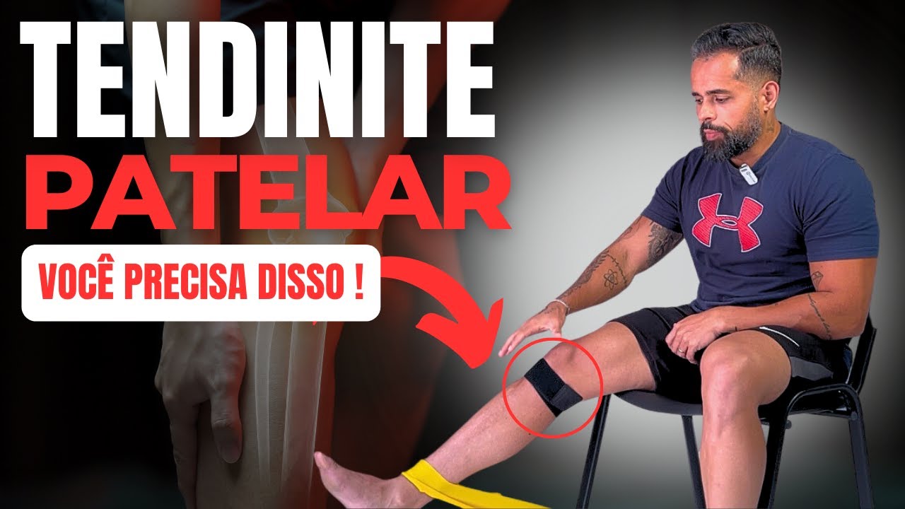 🚨[INÉDITO]🚨TRATANDO TENDINITE PATELAR: O QUE NINGUÉM TE ENSINOU!