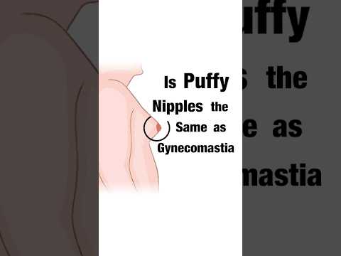 Are Puffy Nipples The Same As Gynecomastia? Dr. Aniketh Venkataram, The Venkat Center, Bengaluru