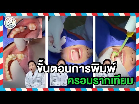 ขั้นตอน