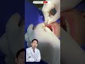 ขั้นตอน