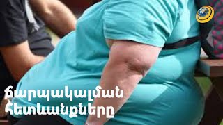 Ճարպակալում. վնասակար ազդեցությունը օրգանիզմի վրա