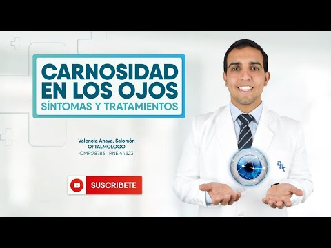Carnosidad en los ojos o Pterigión