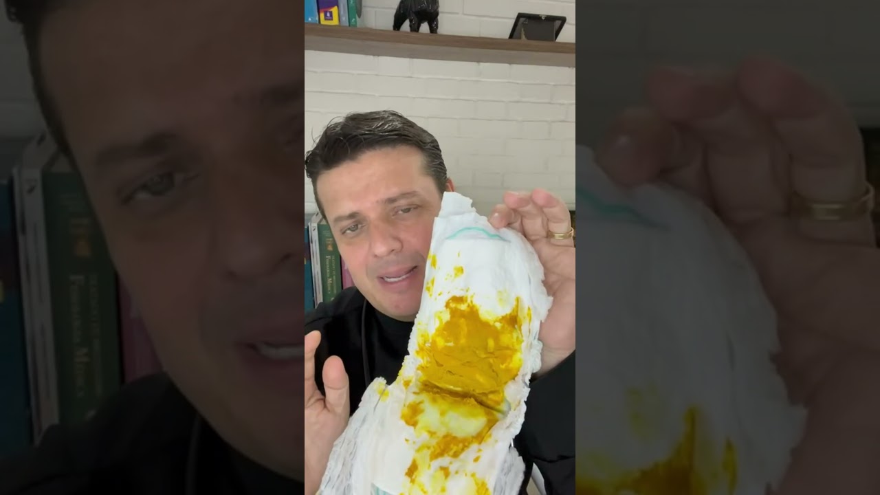 DEVO ME PROCUPAR COM ESSAS MANCHINHAS PRETAS NO COCÔ DO MEU BEBÊ? - DR. FABIANO TEBAS