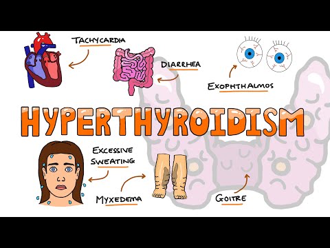 Systemic Lupus Erythematosus Signs and Symptoms SOAP BRAIN MD Mnemonic