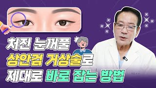 처진눈꺼풀 제대로 바로잡자!