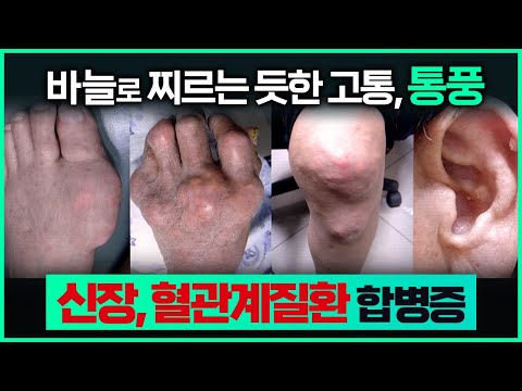 영상 썸네일