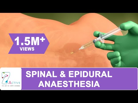 SPINAL & EPIDURAL ANAESTHESIA