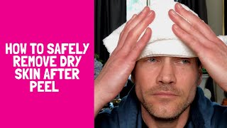 HOW TO SAFELY REMOVE DRY AND FLAKY SKIN AFTER A PEEL