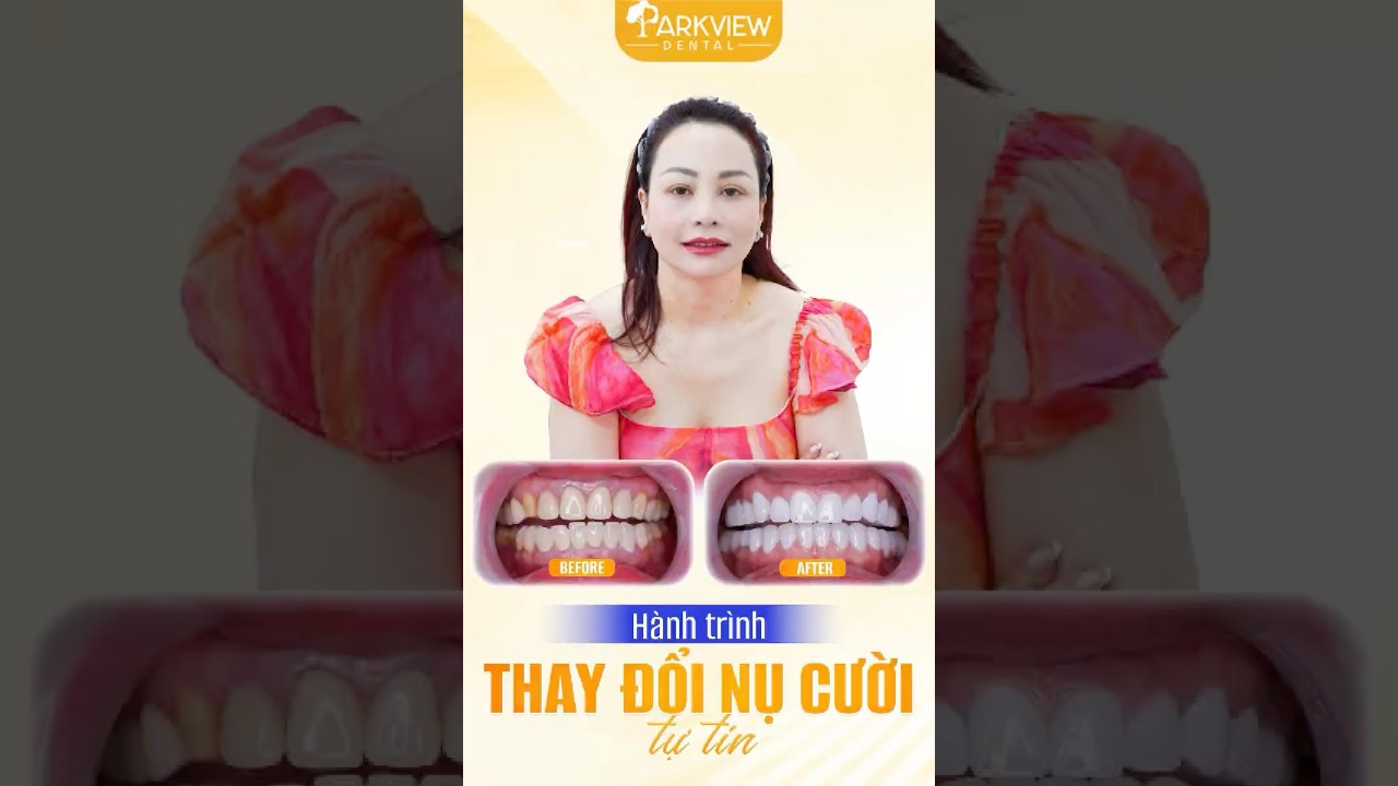 Hành Trình Thay Đổi Nụ Cười – Lấy Lại Tự Tin Tại Parkview Dental